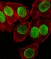 SUMO1 Antibody (N-term)