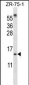 SUMO1 Antibody (N-term)