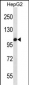 TLR7 Antibody (C-term)