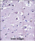 MMP16 Antibody (C-term)