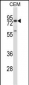 MMP16 Antibody (C-term)