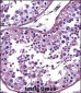 HDAC4 Antibody (C-term)