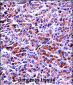 PRSS2 Antibody (Center)