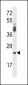 PRSS2 Antibody (Center)