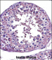 STAT4 Antibody (C-term)