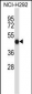 FCGR2A Antibody (C-term)