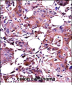 LGALS3 Antibody (C-term)