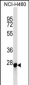 LGALS3 Antibody (C-term)