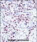 NCK1 Antibody (N-term)