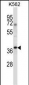 NCK1 Antibody (N-term)