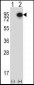 CTTN Antibody (Center)