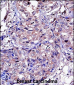 MMP11 Antibody (C-term)