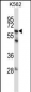 MMP11 Antibody (C-term)