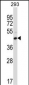 FCGR2C Antibody (C-term)