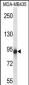 GRM6 Antibody (Center)