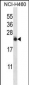 IL13 Antibody (C-term)