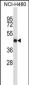 TNFRSF11B Antibody (Center)