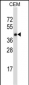 TNFRSF10D Antibody (C-term)