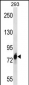 CDH16 Antibody (C-term)