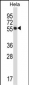 CSK Antibody (N-term)