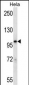 STAT2 Antibody (N-term)