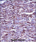 MMP15 Antibody (N-term)