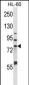 MMP15 Antibody (N-term)