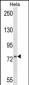 MSN Antibody (C-term)