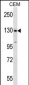 SF3B1 Antibody (N-term)