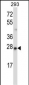 MBD3 Antibody (N-term)