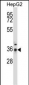 PPP4C Antibody (Center)