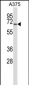 PPP3CA Antibody (C-term)