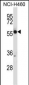 CRMP1 Antibody (N-term)