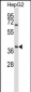 AMBP Antibody (N-term)