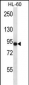 CD97 Antibody (C-term)