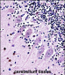TRPC5 Antibody (N-term)