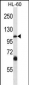 TRPC5 Antibody (N-term)