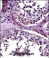 PRMT5 Antibody (N-term)
