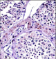 NR0B1 Antibody (Center)