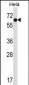 NR0B1 Antibody (Center)