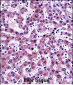 NNMT Antibody (Center)