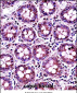 RANGAP1 Antibody (N-term)