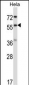 RANGAP1 Antibody (N-term)