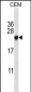 CBX5 Antibody (Center)