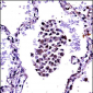 NFKBIB Antibody (C-term)