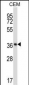 NFKBIB Antibody (C-term)