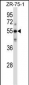 C9 Antibody (Center)