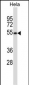 MAVS Antibody (C-term)