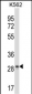 LAIR1 Antibody (Center)