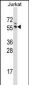 G3BP1 Antibody (C-term)